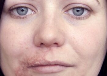 Facing the World Again