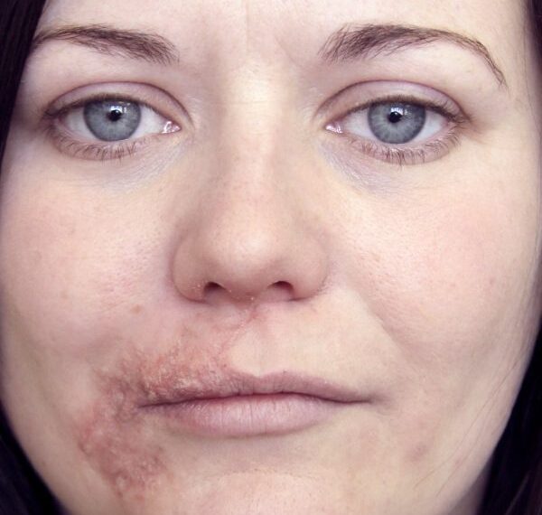 Facing the World Again